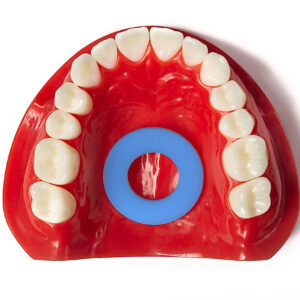 mewing appliance in dental model