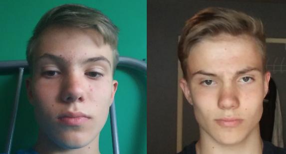 My Mewing Transformation! (16 - 20) 