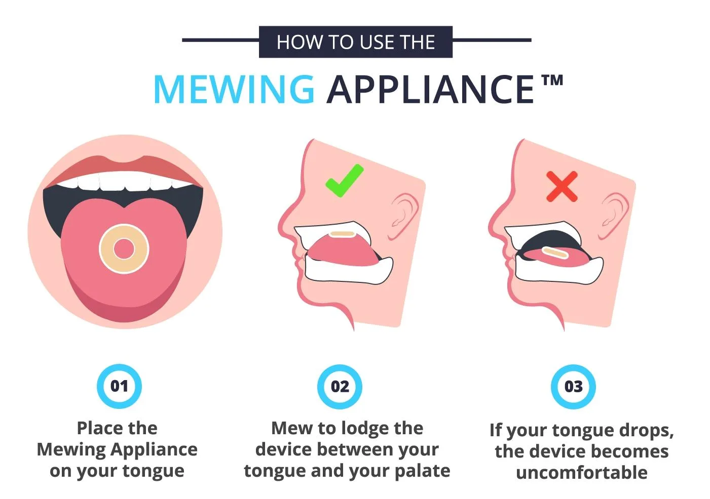 How to use the Mewing Appliance