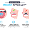Mewing Appliance - Mewing Appliance