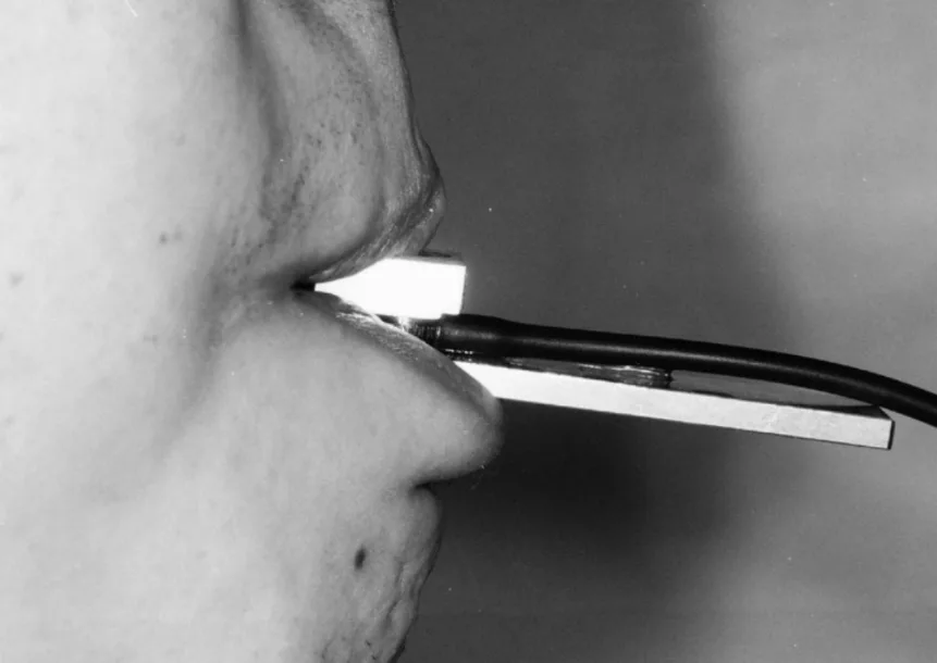 device to measure tongue strenght